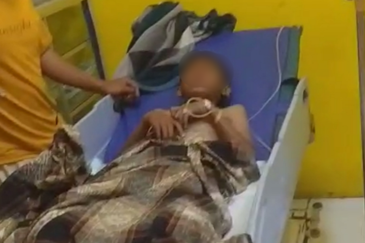 Dua anak di Sampang alami luka bakar akibat ledakan petasan rakitan dari kaleng susu bekas